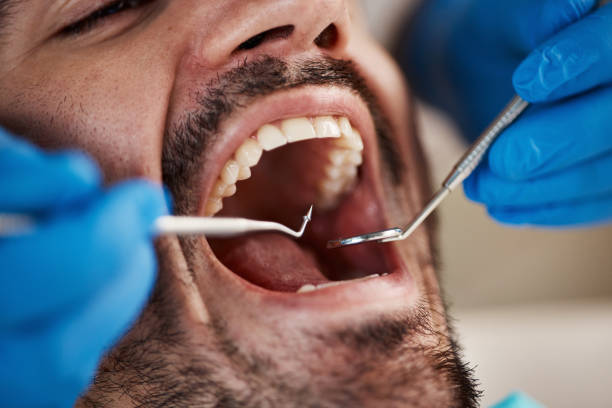 Best Emergency Dentist for Knocked-Out Tooth in Seminole, OK